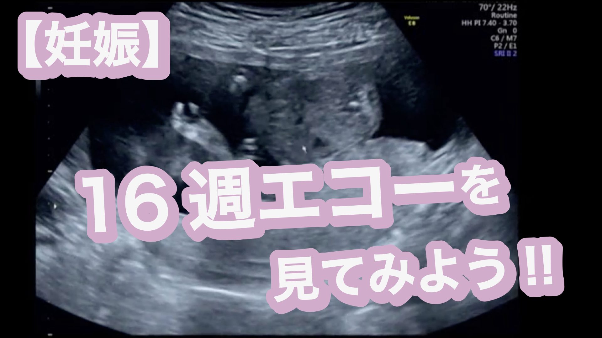 【動画あり】16週エコーを見てみよう！【妊娠・妊活】